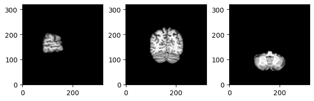 ../../../_images/_generated_notebooks_how_to_viz_mri_8_0.png