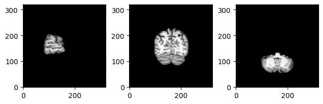 ../../../_images/_notebooks_how_to_all_viz_mri_8_0.png