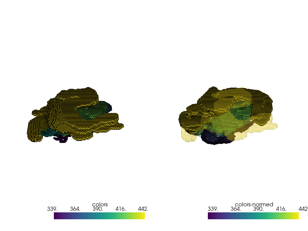 ../../_images/_notebooks_tutorials_mri_left_right_25_0.png