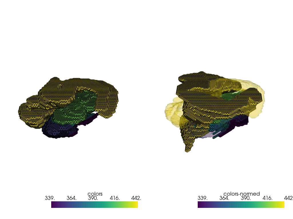 ../../_images/_notebooks_tutorials_mri_left_right_30_0.png